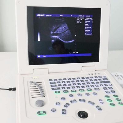 qualità GYN Factory Supply Dw580 Portable Ultrasound Machine For Sale fabbrica