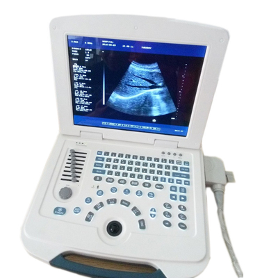 Macchina portatile multilingue di ultrasuono di operazione facile d'acciaio